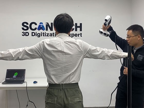 iReal 3D无光扫描 – 脊柱矫形扫描演示