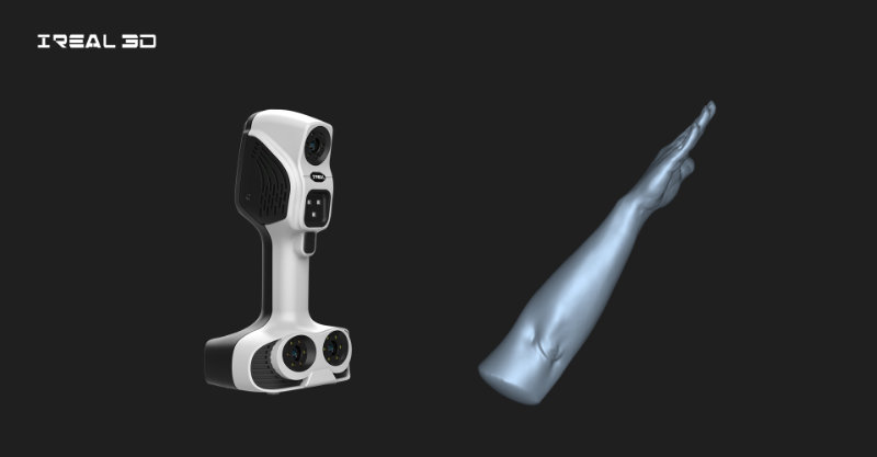 3D打印手臂辅具